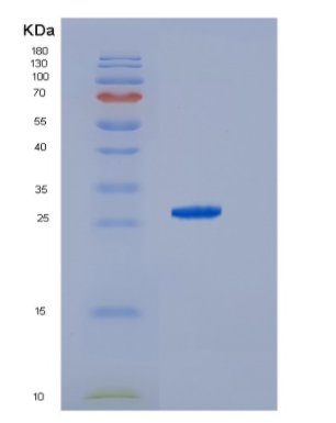 Recombinant HCV NS3 Protein,Recombinant HCV NS3 Protein