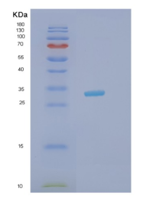 Recombinant Human HAX1 Protein,Recombinant Human HAX1 Protein