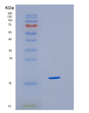 Recombinant Human HBQ1 Protein,Recombinant Human HBQ1 Protein