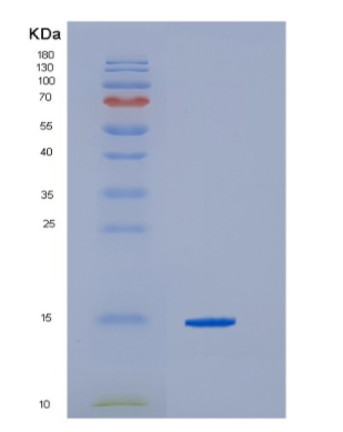 Recombinant Hepatitis C virusHCV-Core Protein,Recombinant Hepatitis C virusHCV-Core Protein