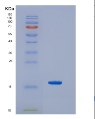 Recombinant Hepatitis C Virus HCV-NS5b Protein,Recombinant Hepatitis C Virus HCV-NS5b Protein