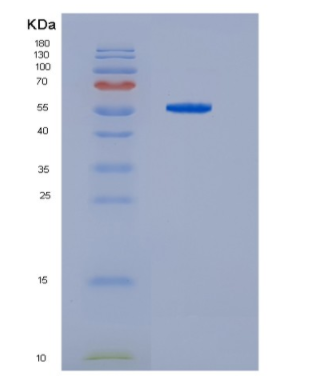 Recombinant Human HDAC2 Protein,Recombinant Human HDAC2 Protein