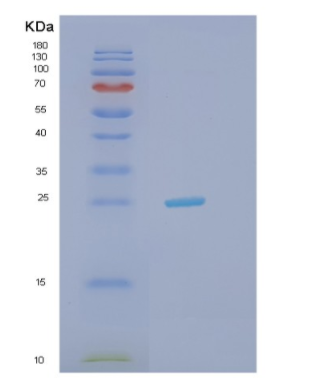 Recombinant Human HDDC2 Protein,Recombinant Human HDDC2 Protein