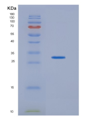 Recombinant Human HDHD2 Protein,Recombinant Human HDHD2 Protein