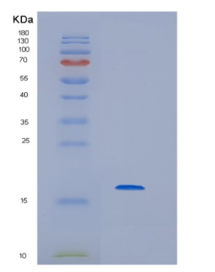 Recombinant Human HBG2 Protein,Recombinant Human HBG2 Protein