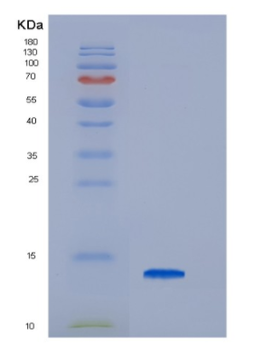 Recombinant Hepatitis C Virus HCV-NS5a Protein,Recombinant Hepatitis C Virus HCV-NS5a Protein