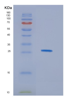 Recombinant Human HDHD1A Protein,Recombinant Human HDHD1A Protein