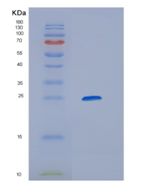 Recombinant Mouse Hepatitis A virus cellular receptor 1 Protein,Recombinant Mouse Hepatitis A virus cellular receptor 1 Protein