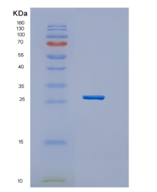 Recombinant Human HES7 Protein,Recombinant Human HES7 Protein