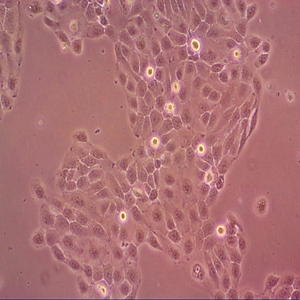 NCI-H1573人肺腺癌细胞,NCI-H1573