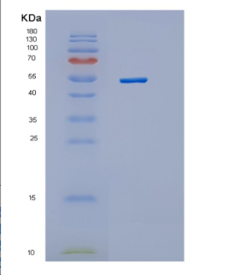 Recombinant Human Hexokinase 4 Human Protein,Recombinant Human Hexokinase 4 Human Protein