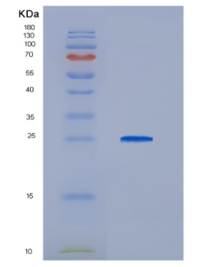 Recombinant HCV-E2 Protein,Recombinant HCV-E2 Protein