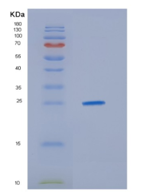 Recombinant Human HDGFRP3 Protein,Recombinant Human HDGFRP3 Protein