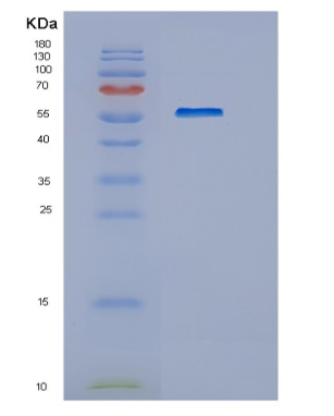 Recombinant Human HEXA Protein,Recombinant Human HEXA Protein