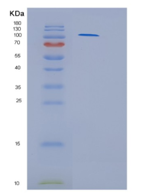 Recombinant Human Hexokinase 3 Human Protein,Recombinant Human Hexokinase 3 Human Protein