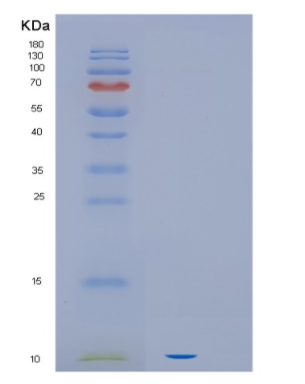 Recombinant Human HIF1a Protein,Recombinant Human HIF1a Protein