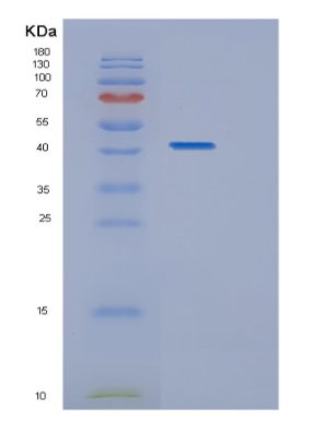 Recombinant Human HDAC8 Protein,Recombinant Human HDAC8 Protein