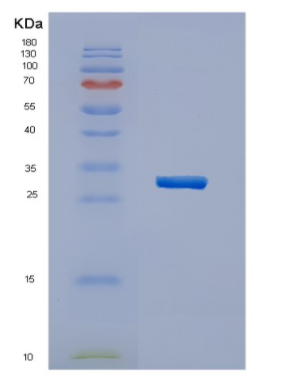 Recombinant Human HERPUD1 Protein,Recombinant Human HERPUD1 Protein