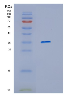 Recombinant Human HFE Protein,Recombinant Human HFE Protein