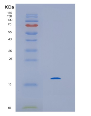 Recombinant Human HINT2 Protein,Recombinant Human HINT2 Protein