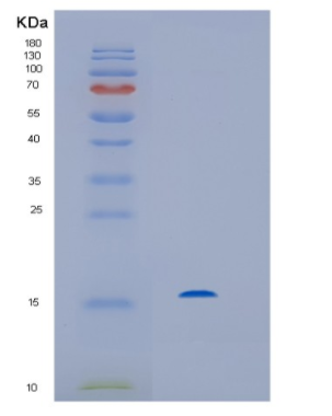 Recombinant Streptomyces avidiniiHis-Streptavidin Protein,Recombinant Streptomyces avidiniiHis-Streptavidin Protein