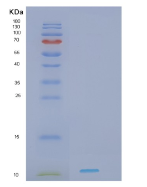 Recombinant Human HDGF Protein,Recombinant Human HDGF Protein