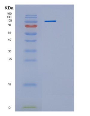 Recombinant Human Hexokinase 2 Human Protein,Recombinant Human Hexokinase 2 Human Protein