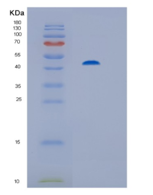 Recombinant Human His-PP2Cα(His-tagging Protein phosphatase 2C) Protein,Recombinant Human His-PP2Cα(His-tagging Protein phosphatase 2C) Protein