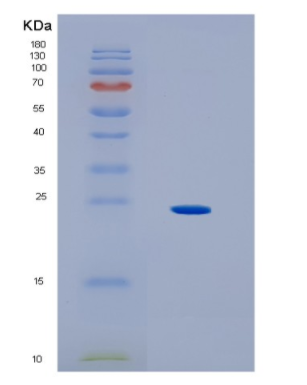 Recombinant Human HLA-DOA Protein,Recombinant Human HLA-DOA Protein