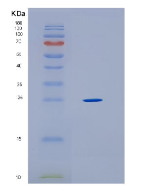 Recombinant Human HLA-DRB1 Protein,Recombinant Human HLA-DRB1 Protein