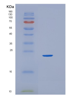 Recombinant Human HEBP1 Protein,Recombinant Human HEBP1 Protein