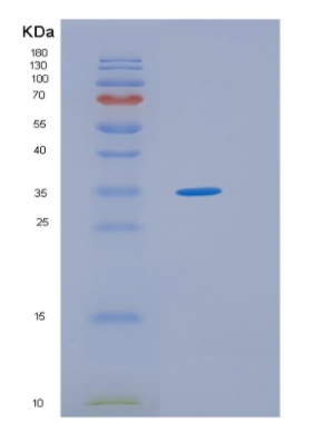 Recombinant Human HLF Protein,Recombinant Human HLF Protein