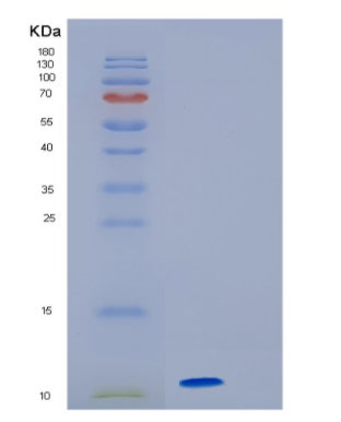 Recombinant Human HMGA2 Protein,Recombinant Human HMGA2 Protein