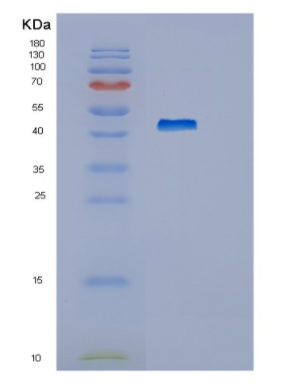 Recombinant Human HEXIM1 Protein,Recombinant Human HEXIM1 Protein