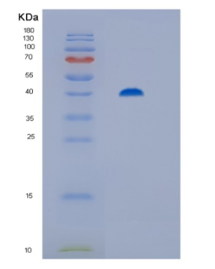 Recombinant Human Hip/ST13 Protein,Recombinant Human Hip/ST13 Protein