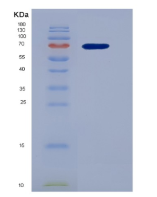 Recombinant Hepatocyte Growth Factor (HGF),Recombinant Hepatocyte Growth Factor (HGF)