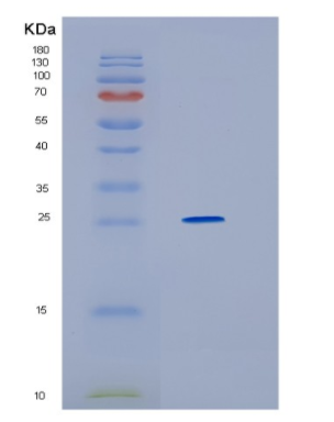 Recombinant Human HMGB2 Protein,Recombinant Human HMGB2 Protein
