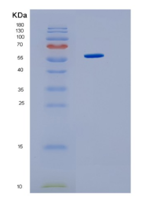 Recombinant Human HMGCS1 Protein,Recombinant Human HMGCS1 Protein
