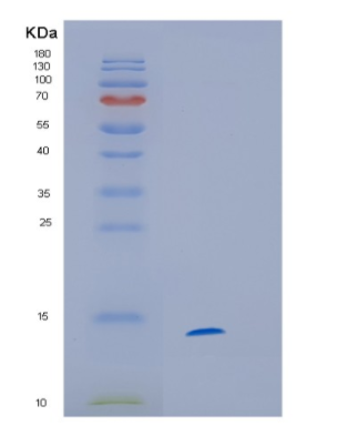 Recombinant Human HINT1 Protein,Recombinant Human HINT1 Protein