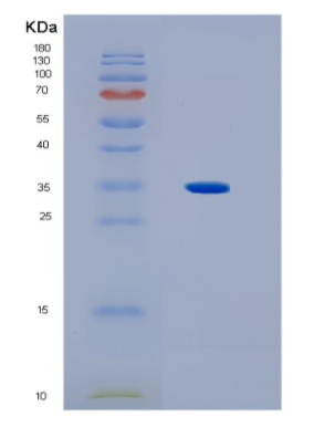 Recombinant Human HLA-C Protein,Recombinant Human HLA-C Protein