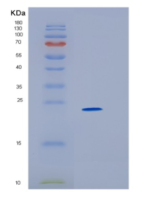 Recombinant Human HLA-DRA Protein,Recombinant Human HLA-DRA Protein