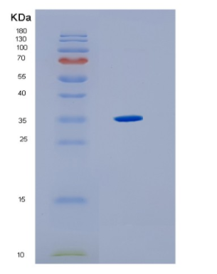 Recombinant Human HLA-F Protein,Recombinant Human HLA-F Protein