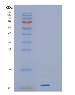 Recombinant Human HMGA1 Protein,Recombinant Human HMGA1 Protein