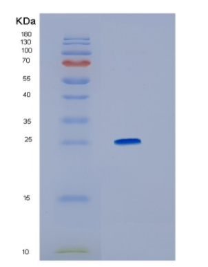 Recombinant Human HMGB1 Protein,Recombinant Human HMGB1 Protein