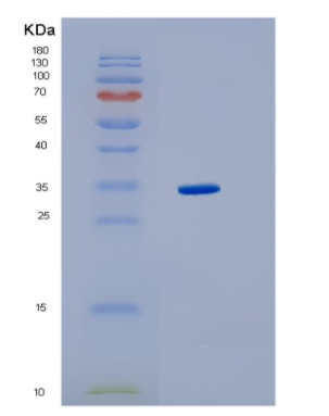 Recombinant Human HMGCL Protein,Recombinant Human HMGCL Protein