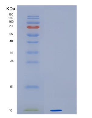 Recombinant Human HMGN3 Protein,Recombinant Human HMGN3 Protein