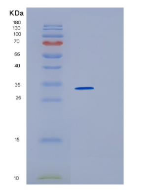 Recombinant Human HMOX2 Protein,Recombinant Human HMOX2 Protein