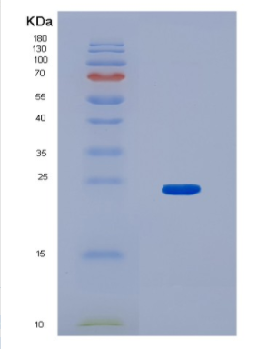 Recombinant Human HN1L Protein,Recombinant Human HN1L Protein