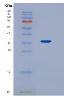 Recombinant Human HNMT Protein,Recombinant Human HNMT Protein