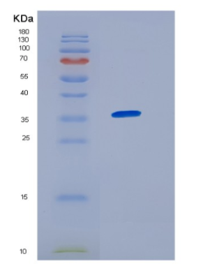 Recombinant Human HNRNPA1 Protein,Recombinant Human HNRNPA1 Protein